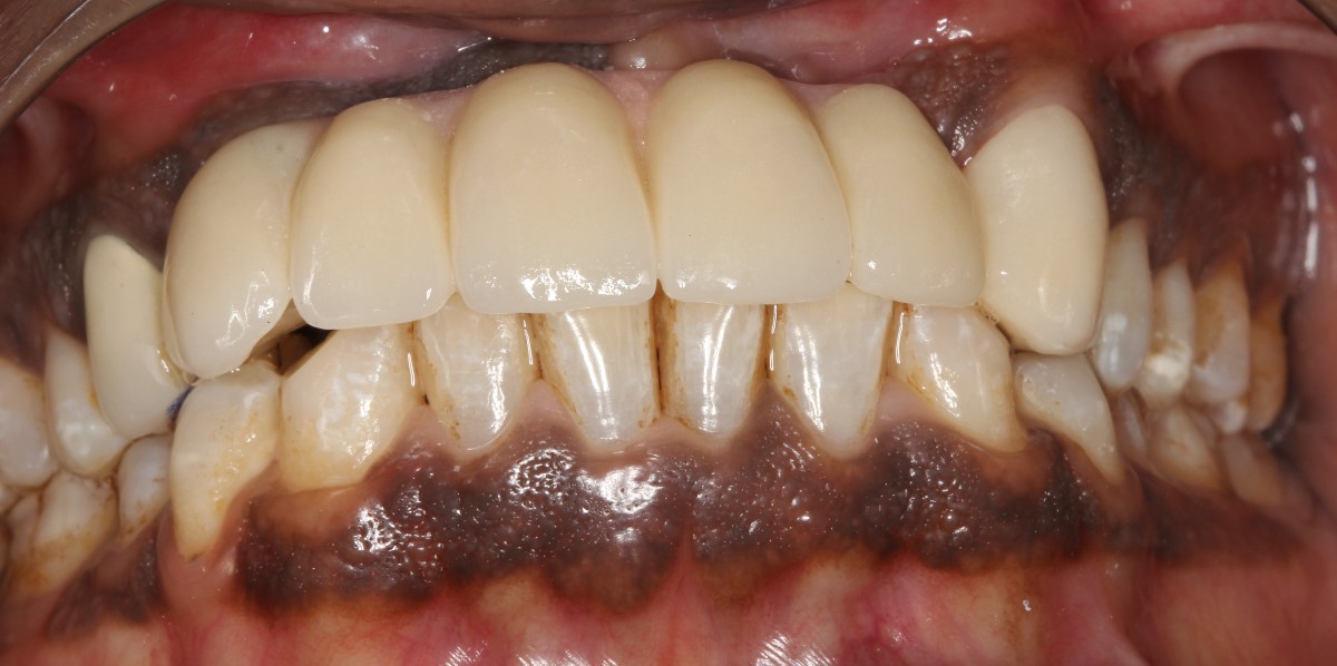After Image