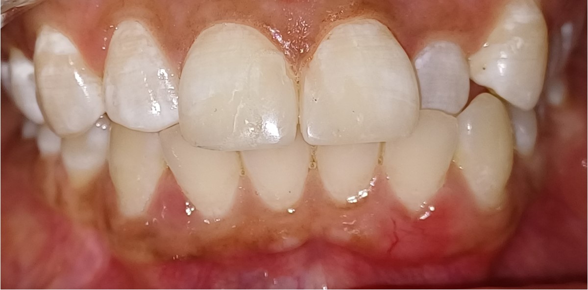 After Image