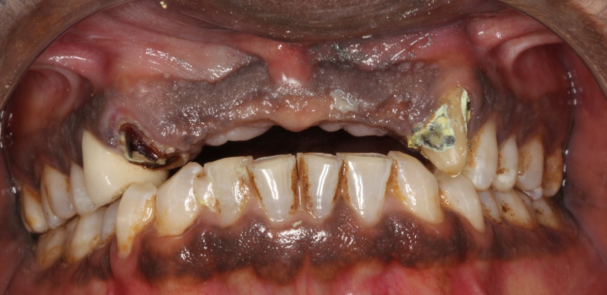 Before Image
